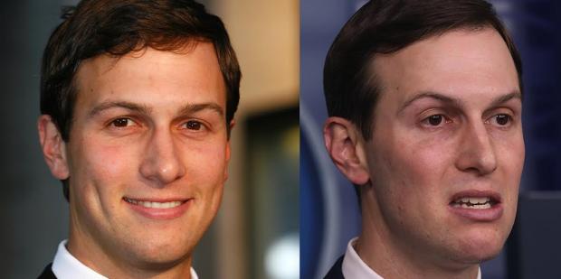 What Happened To Jared Kushner’s Face? Startling Before/After Photos