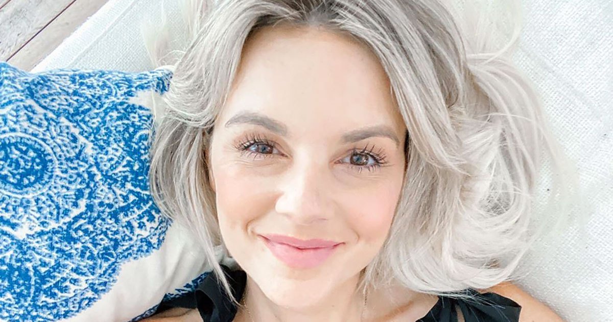 Ali Fedotowsky Recalls Her Skin Cancer Diagnosis, Details How Fans Can Give Back to the American Cancer Society
