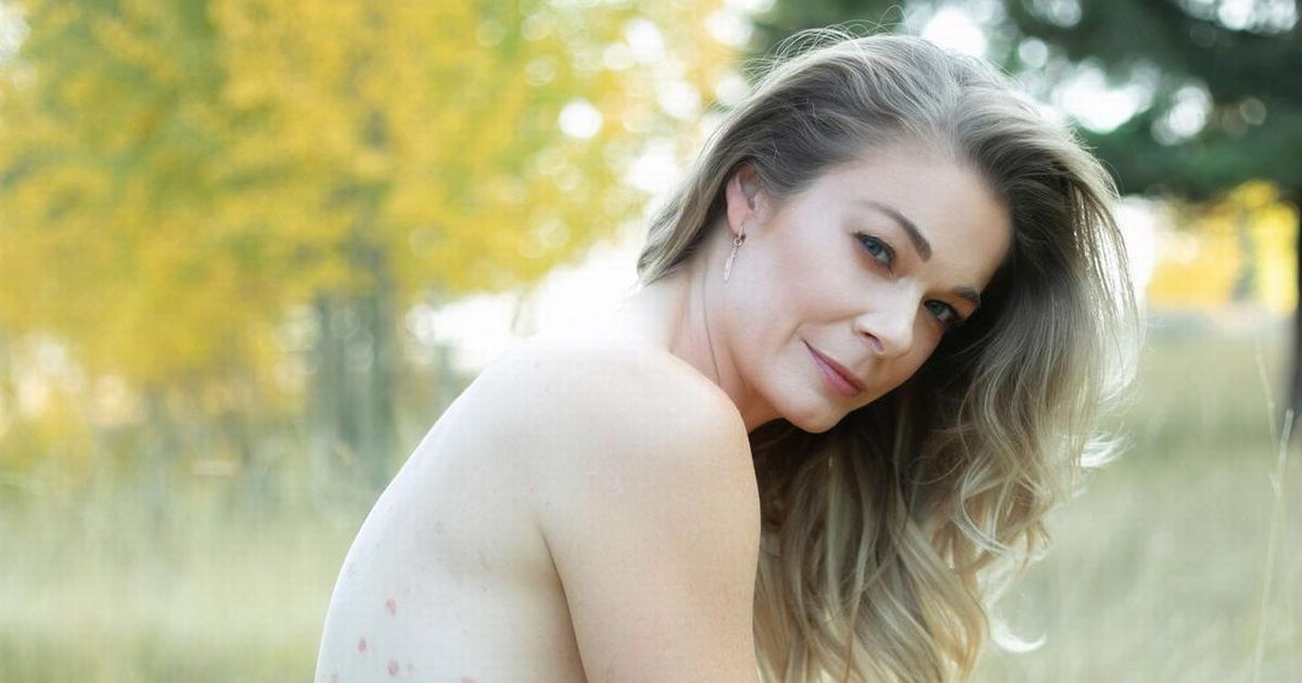 Emotional LeAnn Rimes ‘overwhelmed’ by support after sharing nude psoriasis snaps
