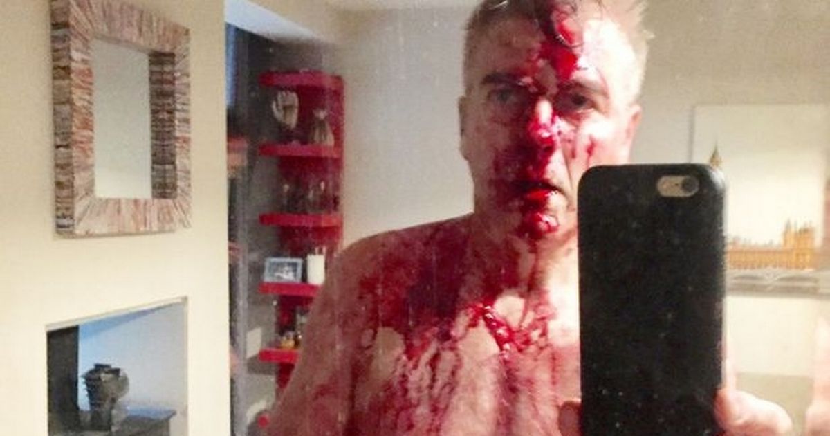 Married at First Sight star recalls night he fought off machete wielding burglars