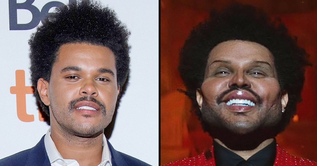 The Weeknd Prompts Fan Speculation About Plastic Surgery After Revealing New Look in ‘Save Your Tears’ Video