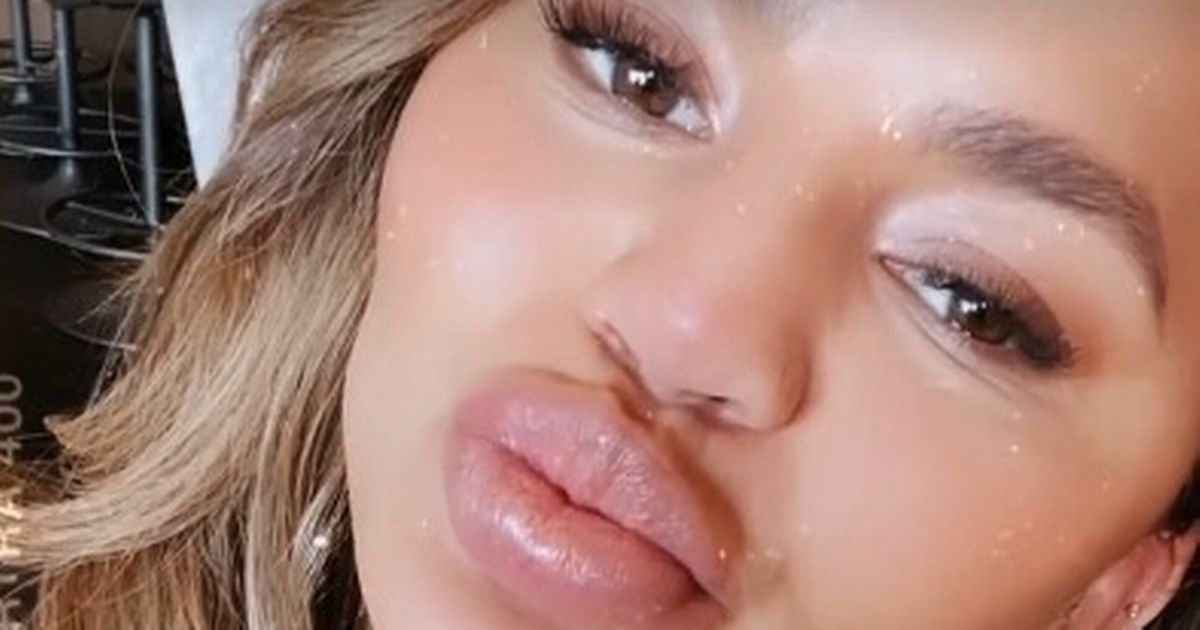Chrissy Teigen displays painful swollen lips after mystery allergic reaction