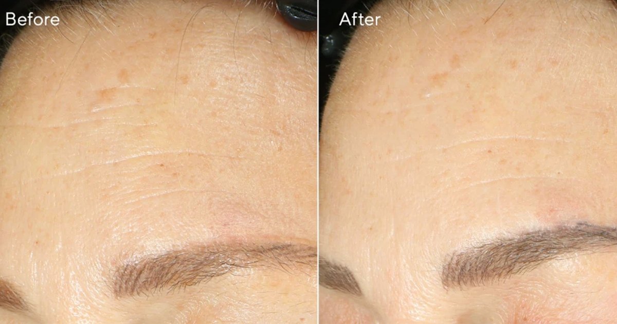 Holy Skin! This Is the No. 1 Retinol Night Cream in the U.S.